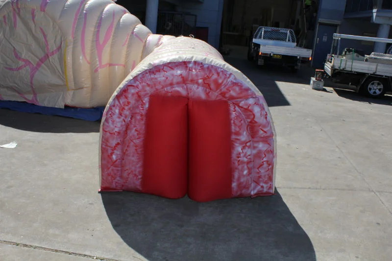Exterior view of the intestinal section entry